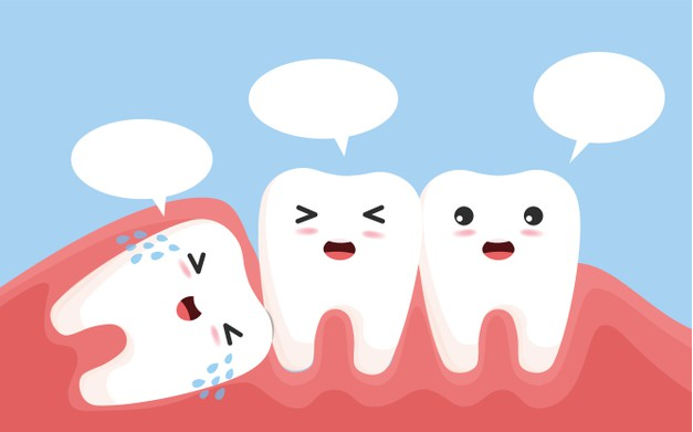 Wisdom Tooth Removal-illustration