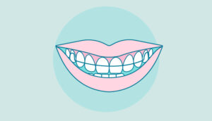 What is the Difference between Invisalign and Retainers?