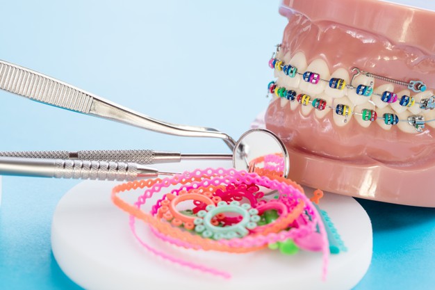 multicolored-dental-braces