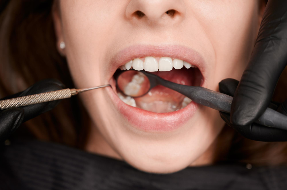 Post-Root Canal Pain – What to Expect? What to Do?